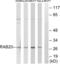 RAB20, Member RAS Oncogene Family antibody, LS-C120306, Lifespan Biosciences, Western Blot image 