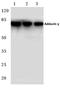 Adducin 3 antibody, AP06788PU-N, Origene, Western Blot image 