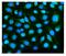 DYSF antibody, A01234-3, Boster Biological Technology, Immunofluorescence image 