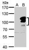 L3MBTL Histone Methyl-Lysine Binding Protein 1 antibody, PA5-30499, Invitrogen Antibodies, Western Blot image 