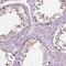 TP53 Target 5 antibody, NBP2-13467, Novus Biologicals, Immunohistochemistry paraffin image 