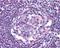 C-C Motif Chemokine Receptor 5 (Gene/Pseudogene) antibody, ADI-905-277-100, Enzo Life Sciences, Immunohistochemistry paraffin image 