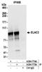 Zinc phosphodiesterase ELAC protein 2 antibody, A304-775A, Bethyl Labs, Immunoprecipitation image 