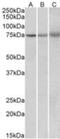 Kelch Like Family Member 6 antibody, NBP1-46128, Novus Biologicals, Western Blot image 