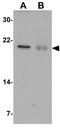 BCL2 Related Protein A1 antibody, GTX31738, GeneTex, Western Blot image 