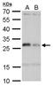 HLA class II histocompatibility antigen, DM alpha chain antibody, TA308310, Origene, Western Blot image 