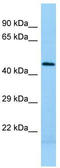 Protein Kinase CAMP-Dependent Type I Regulatory Subunit Alpha antibody, TA344578, Origene, Western Blot image 