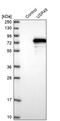 Ubiquitin carboxyl-terminal hydrolase 49 antibody, PA5-56417, Invitrogen Antibodies, Western Blot image 