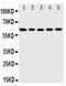 Iduronate 2-Sulfatase antibody, PA5-79439, Invitrogen Antibodies, Western Blot image 