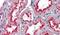 DNA dC->dU-editing enzyme APOBEC-3G antibody, PA5-18701, Invitrogen Antibodies, Immunohistochemistry frozen image 