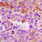 Collagen Type IV Alpha 5 Chain antibody, GTX56030, GeneTex, Immunohistochemistry paraffin image 