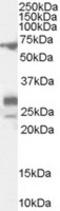 Sal-like protein 4 antibody, TA303235, Origene, Western Blot image 