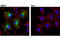 GFAP antibody, 3670S, Cell Signaling Technology, Immunocytochemistry image 