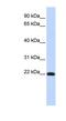 FXYD Domain Containing Ion Transport Regulator 5 antibody, NBP1-59138, Novus Biologicals, Western Blot image 