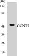 Glucosaminyl (N-Acetyl) Transferase Family Member 7 antibody, LS-C291984, Lifespan Biosciences, Western Blot image 