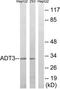 ANT2 antibody, TA313451, Origene, Western Blot image 