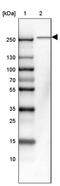 Tetratricopeptide Repeat Domain 3 antibody, PA5-53494, Invitrogen Antibodies, Western Blot image 