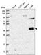 Zinc Finger Protein 385B antibody, NBP2-58807, Novus Biologicals, Western Blot image 