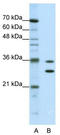 Methenyltetrahydrofolate Synthetase Domain Containing antibody, TA343917, Origene, Western Blot image 