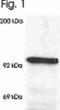 Nuclear Receptor Subfamily 3 Group C Member 1 antibody, M00503-1, Boster Biological Technology, Western Blot image 