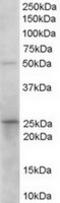 15-Hydroxyprostaglandin Dehydrogenase antibody, TA302977, Origene, Western Blot image 