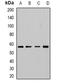Cytochrome P450 Family 3 Subfamily A Member 5 antibody, abx225135, Abbexa, Western Blot image 