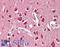 Unc-5 Netrin Receptor C antibody, LS-B8305, Lifespan Biosciences, Immunohistochemistry paraffin image 