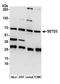 SET Domain Containing 3, Actin Histidine Methyltransferase antibody, A304-071A, Bethyl Labs, Western Blot image 