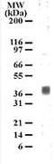 5-Hydroxytryptamine Receptor 1B antibody, ab13896, Abcam, Western Blot image 