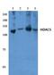 Histone deacetylase 5 antibody, AP06159PU-N, Origene, Western Blot image 