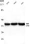 GAPDH antibody, STJ98494, St John