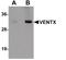 VENT Homeobox antibody, PA5-21006, Invitrogen Antibodies, Western Blot image 