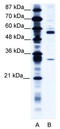 Coronin 1A antibody, TA335667, Origene, Western Blot image 