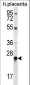 LHFPL Tetraspan Subfamily Member 1 antibody, LS-C160046, Lifespan Biosciences, Western Blot image 