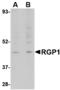 Retrograde Golgi transport protein RGP1 homolog antibody, A09229, Boster Biological Technology, Western Blot image 