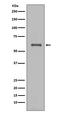 NADPH Oxidase 4 antibody, M00403, Boster Biological Technology, Western Blot image 