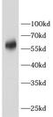 Carnitine O-Acetyltransferase antibody, FNab10449, FineTest, Western Blot image 