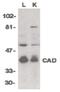 DNA Fragmentation Factor Subunit Beta antibody, PA5-19892, Invitrogen Antibodies, Western Blot image 