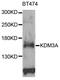 Lysine Demethylase 3A antibody, MBS127901, MyBioSource, Western Blot image 