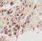 SUZ12 Polycomb Repressive Complex 2 Subunit antibody, FNab08406, FineTest, Immunohistochemistry frozen image 