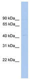 Eukaryotic initiation factor 4A-III antibody, TA341591, Origene, Western Blot image 