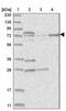 Kelch Like Family Member 17 antibody, NBP1-85926, Novus Biologicals, Western Blot image 
