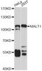 Mucosa-associated lymphoid tissue lymphoma translocation protein 1 antibody, A2144, ABclonal Technology, Western Blot image 