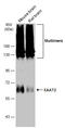GLT-1 antibody, GTX134062, GeneTex, Western Blot image 