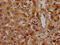 Glutamyl-TRNA Amidotransferase Subunit B antibody, CSB-PA017792LA01HU, Cusabio, Immunohistochemistry paraffin image 