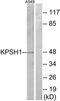 Protein Serine Kinase H1 antibody, TA312327, Origene, Western Blot image 