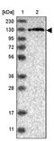 Ubiquitin carboxyl-terminal hydrolase 48 antibody, PA5-56320, Invitrogen Antibodies, Western Blot image 