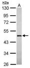 Group XV phospholipase A2 antibody, GTX120468, GeneTex, Western Blot image 