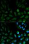 Capping Actin Protein Of Muscle Z-Line Subunit Alpha 2 antibody, orb48301, Biorbyt, Immunofluorescence image 