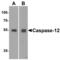Caspase-12 antibody, GTX28117, GeneTex, Western Blot image 